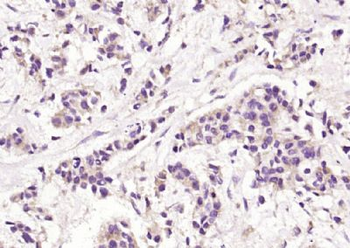 SPINK7 Polyclonal Antibody