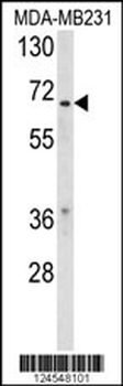 RXRB Antibody (Center)