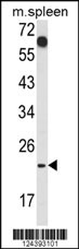 CD7 Antibody (Center)