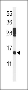 PDCD5 Antibody (N-term)