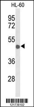 CD209 Antibody (Center)
