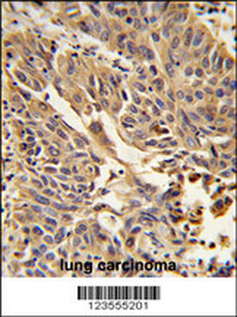 JUP Antibody (C-term)