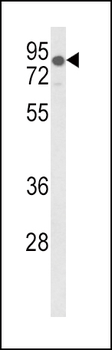 LDLR Antibody (Center)