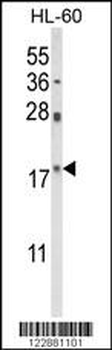 PIN1 Antibody (Center)