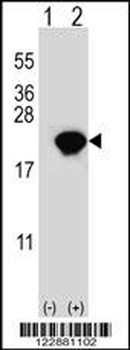 PIN1 Antibody (Center)