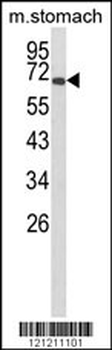 GLIS1 Antibody (N-term)