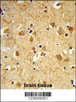 DNM3 Antibody (Center)