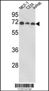 ABI1 Antibody (N-term)