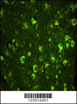 ABI1 Antibody (N-term)