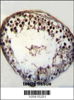 BRSK1 Antibody (C-term)