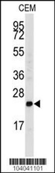 FGF4 Antibody (C-term)