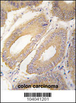 FGF4 Antibody (C-term)