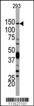 PI3KCD Antibody (N-term)