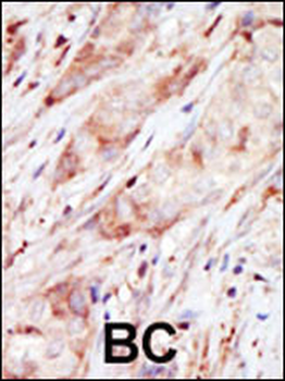 GCK Antibody (C-term)