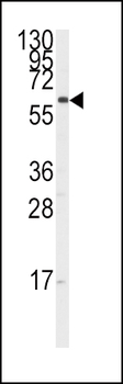 CYP17A1 Antibody (Center)