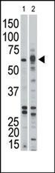 Activin A Receptor Type IB (ACVR1B) Antibody (Center)