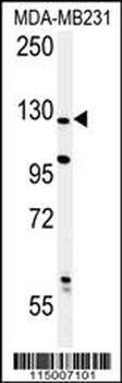PHLPP2 Antibody (C-term)
