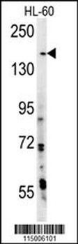 PHLPP2 Antibody (N-term)