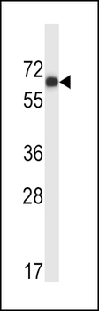 MATK Antibody (N-term)