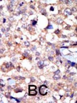 c ABL (ABL1) Antibody (C-term)