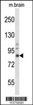 TrkA Antibody