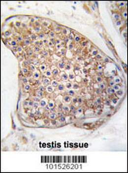 TEK (TIE2) Antibody (C-term)