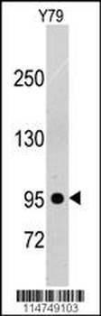 PDGFRB Antibody