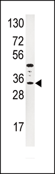 IGFBP3 Antibody (N-term)
