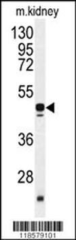 POLDIP2 Antibody (C-term)
