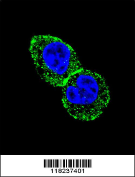 IDH1 Antibody (N-term)