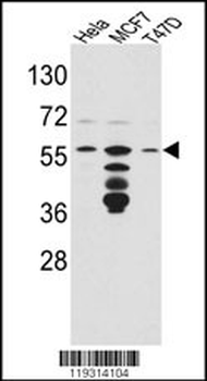 FKBP4 Antibody (Center)
