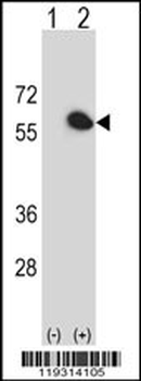 FKBP4 Antibody (Center)