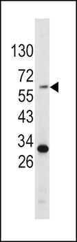Tyrosinase Antibody (C-term)