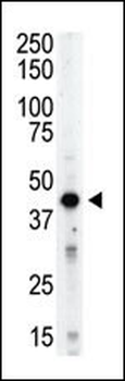 Aurora-B (ARK/STK12) Antibody (Center)