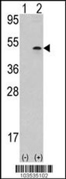 Aurora-B (ARK/STK12) Antibody (Center)