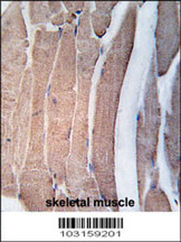 DAPK2 Antibody (N-term)
