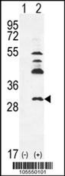 UCK2 Antibody (C-term)