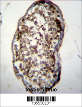 UCK2 Antibody (C-term)