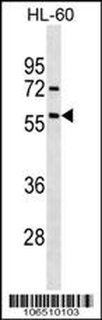 Activin Receptor Type IA (ACVR1) Antibody (Center N153)