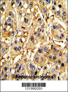 SFRP5 Antibody (Center)