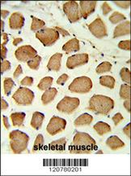 PTPN11 Antibody (C-term)
