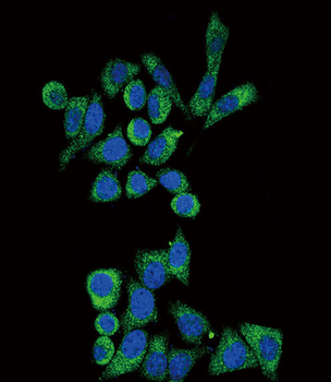 GLA Antibody (N-term)