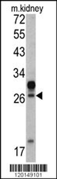 HOXA5 Antibody (C-term E211)
