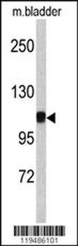 CTNA1 Antibody (N-term)
