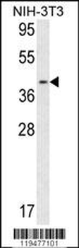 Calponin-3 Antibody (Center)