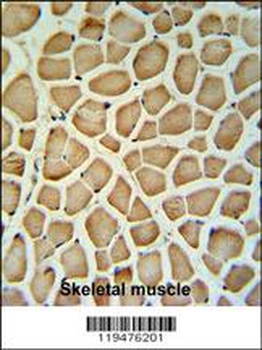 Calponin-3 Antibody (N-term)