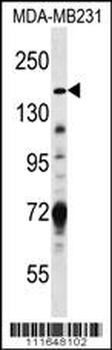 Hamartin (TSC1) Antibody (Center)