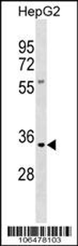 Kallikrein 9 Antibody (N-term)