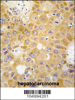 APH1 Antibody (N-term)