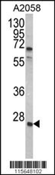 GRB2 Antibody (Center)
